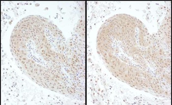 Rabbit anti-PSMC6 Antibody
