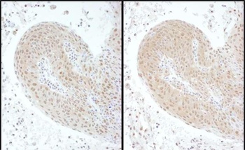 Rabbit anti-PSMC6 Antibody