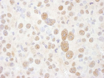 PSMC2 Antibody