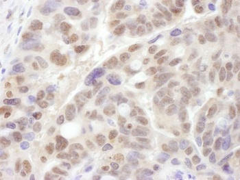 Rabbit anti-PSMC1 Antibody