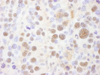 Rabbit anti-PSMC1 Antibody