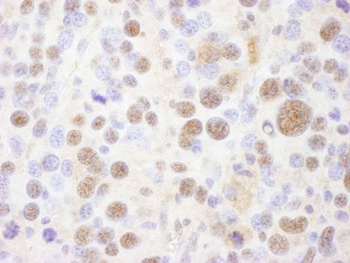 PSMC1 Antibody