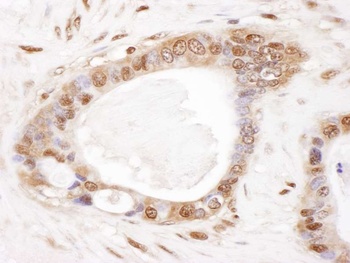 Rabbit anti-PSMB2 Antibody