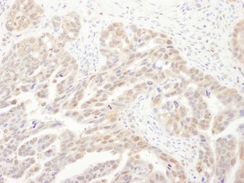 PSMA6 Antibody