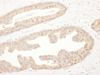 Rabbit anti-PSMA6 Antibody