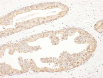 PSMA6 Antibody