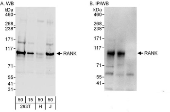 Rabbit RANK Antibody