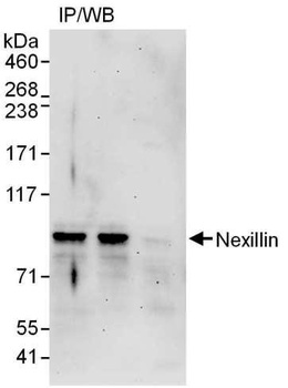 Rabbit Nexilin Antibody