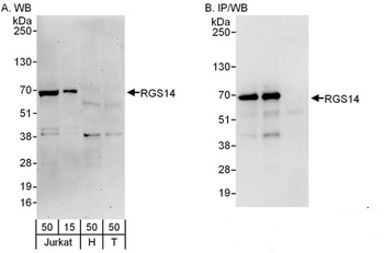 Rabbit RGS14 Antibody