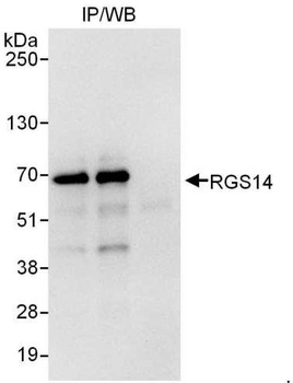 Rabbit RGS14 Antibody