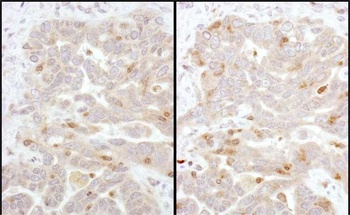 Rabbit anti-Beta-Arrestin 2 Antibody