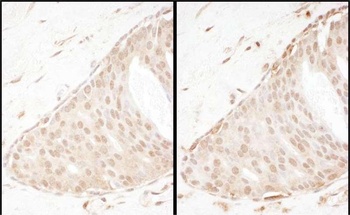 Rabbit anti-Beta-Arrestin 2 Antibody