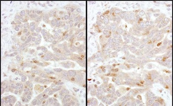 Beta-Arrestin 2 Antibody