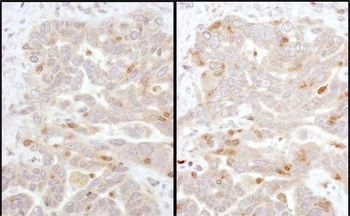Rabbit anti-Beta-Arrestin 2 Antibody