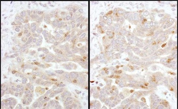 Beta-Arrestin 2 Antibody