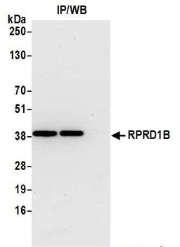 RPRD1B Antibody