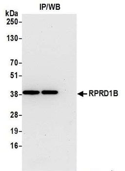 Rabbit anti-RPRD1B Antibody