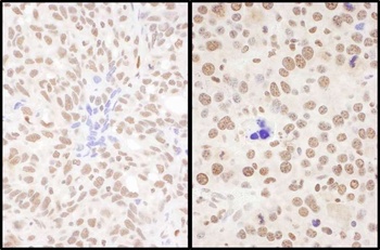 Rabbit anti-SRSF7 Antibody