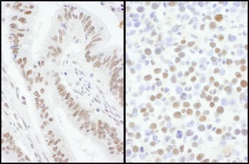 Rabbit anti-SRSF7 Antibody