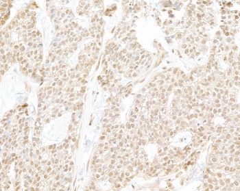 Rabbit anti-RPB3 Antibody