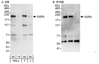 Rabbit SARA Antibody