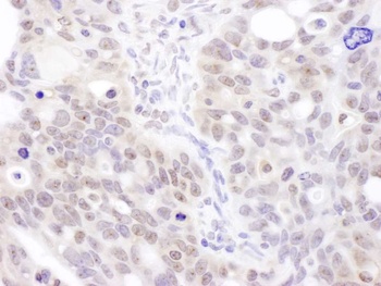 Rabbit anti-Coilin Antibody