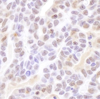 Rabbit anti-Coilin Antibody