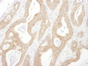 Rabbit anti-Beta-Arrestin 1 Antibody