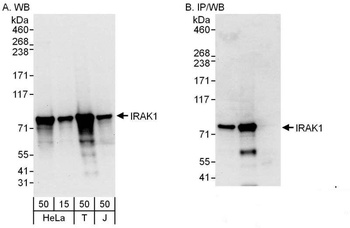 Rabbit IRAK1 Antibody
