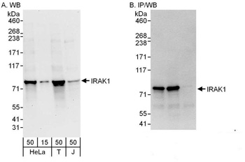 Rabbit IRAK1 Antibody
