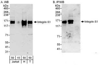 Rabbit Integrin Beta 1 Antibody
