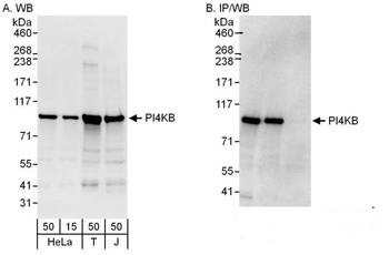Rabbit PI4KB Antibody