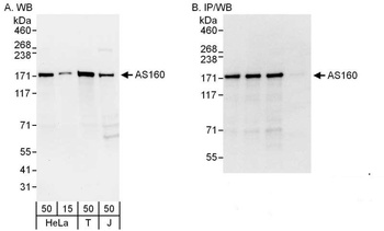Rabbit AS160 Antibody