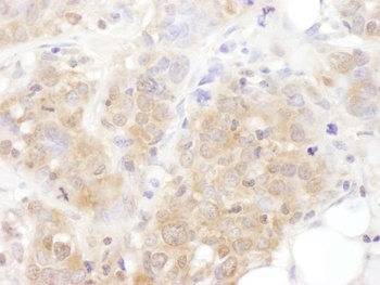 Rabbit AS160 Antibody
