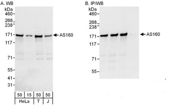 Rabbit AS160 Antibody