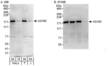 Rabbit AS160 Antibody
