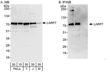 Rabbit LARP7 Antibody