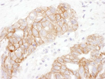 Rabbit Plakoglobin Antibody