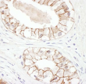 Rabbit Plakoglobin Antibody