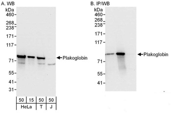 Rabbit Plakoglobin Antibody