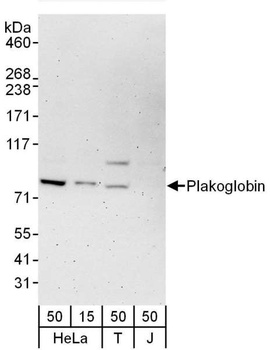 Rabbit Plakoglobin Antibody