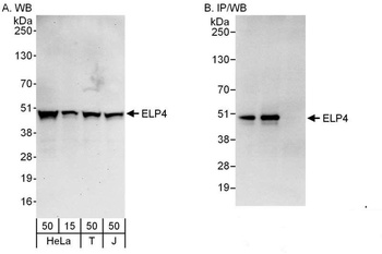 Rabbit ELP4 Antibody