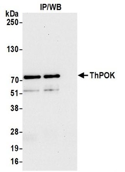Rabbit ThPOK Antibody