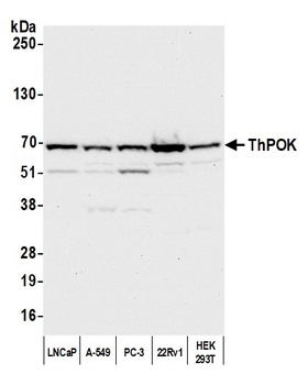Rabbit ThPOK Antibody