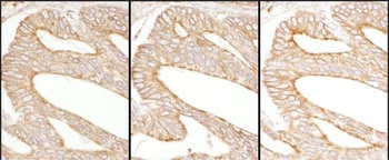 Rabbit Calnexin Antibody