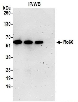 Rabbit anti-Ro60 Antibody
