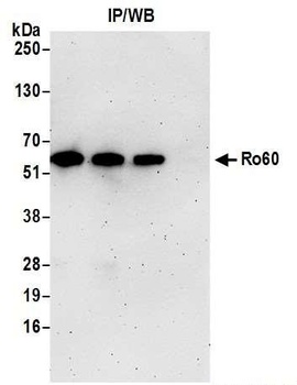 Ro60 Antibody
