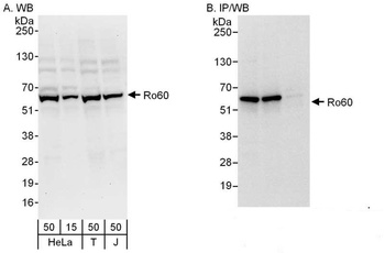 Rabbit Ro60 Antibody