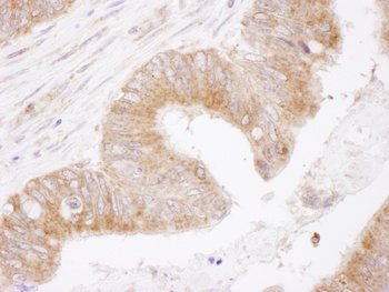 Rabbit anti-Bcl-2 Antibody