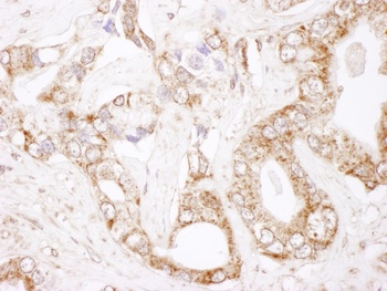Rabbit anti-Bcl-2 Antibody